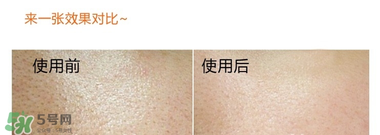 城野醫(yī)生毛孔收斂水真的有用嗎 城野醫(yī)生毛孔收斂水真的有用嗎