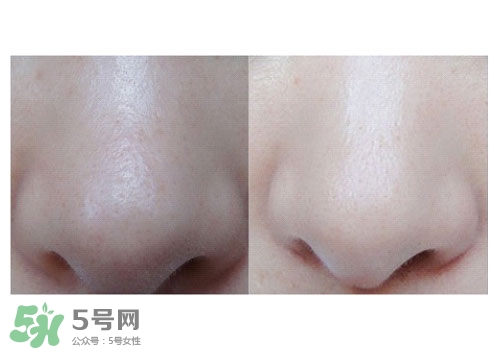 碧柔鼻貼白色和黑色哪個(gè)好？碧柔鼻貼黑白區(qū)別