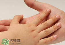 寶寶指甲凹凸不平是什么原因？寶寶指甲凹凸不平正常嗎？