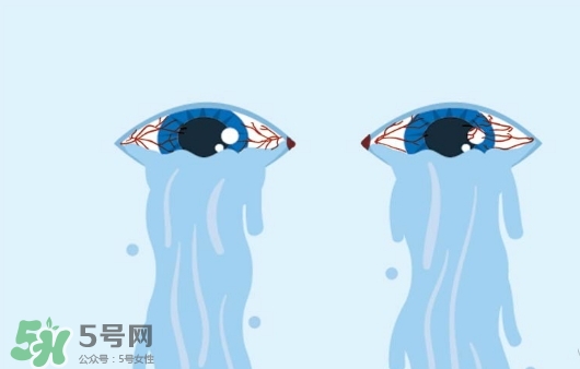 眼藥水可以兩個(gè)人用嗎？眼藥水可以共用嗎？