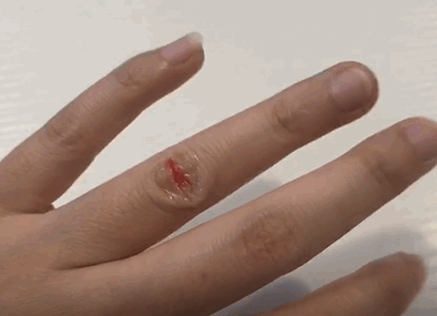 液體創(chuàng)可貼防水嗎？液體創(chuàng)可貼防水嗎透氣嗎？