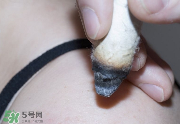 艾灸后為什么會(huì)癢？艾灸后為什么要多喝水