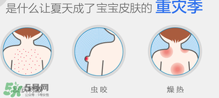 妙思樂爽膚水好用嗎？妙思樂爽膚水能去痱嗎？
