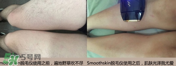 smoothskin和slikn infinity哪個(gè)好？smoothskin脫毛儀怎么樣