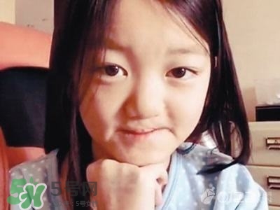 兔唇是什么？兔唇是什么原因造成的？