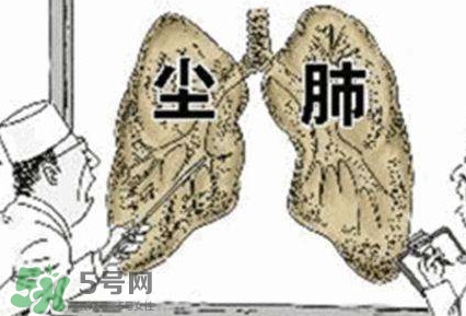 一般幾年時(shí)間會(huì)有塵肺病？塵肺病的早期癥狀