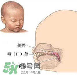 兔唇能檢查出來嗎？兔唇能完全修復(fù)嗎？