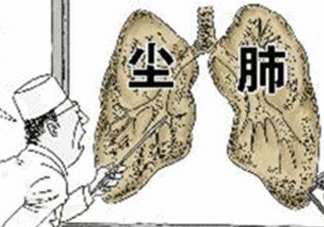 塵肺病能治愈嗎？塵肺病能活多久