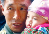 兔唇是什么？兔唇是什么原因造成的？