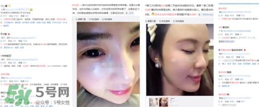 天倍面膜是日本的嗎？日本tenbe天倍面膜騙局