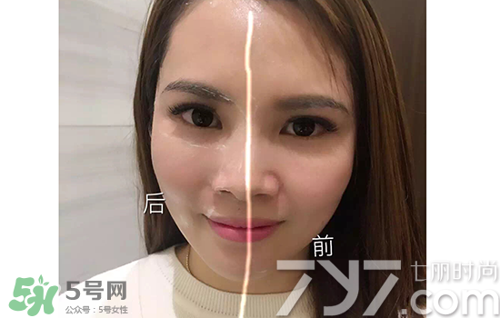 黃金棒有什么用？黃金棒的功效與作用