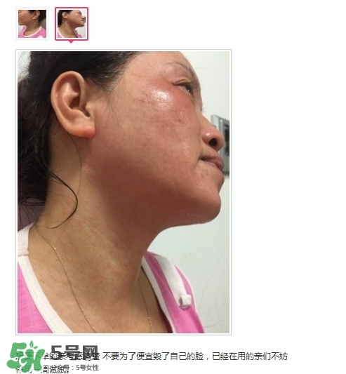 肌膚之食是什么牌子？肌膚之食讓我毀容了