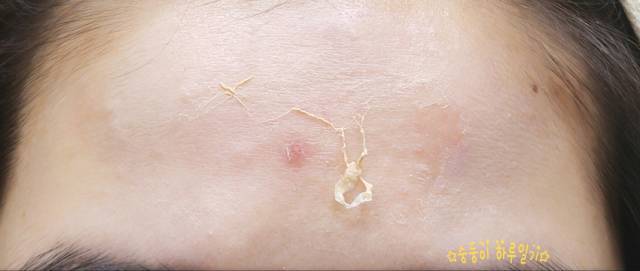real skin patch怎么樣？real skin是什么牌子