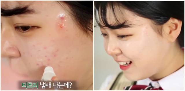 real skin patch怎么樣？real skin是什么牌子