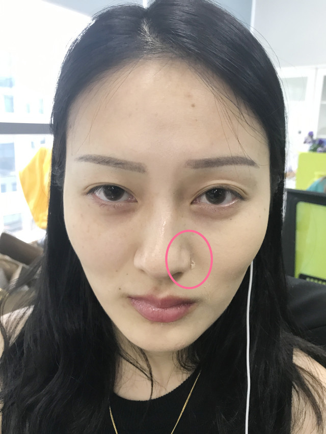 real skin patch怎么樣？real skin是什么牌子