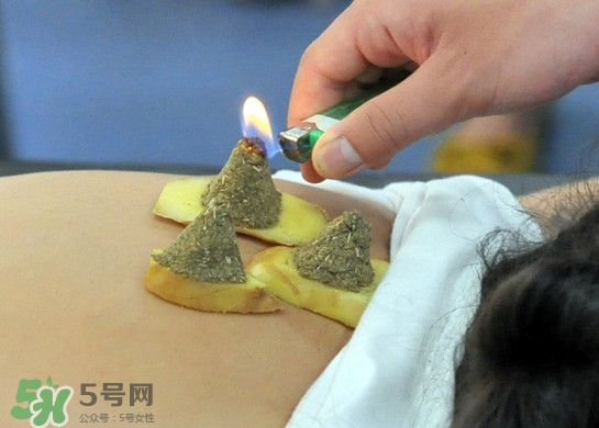 三伏灸有用嗎？2017年三伏艾灸時(shí)間