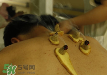 三伏灸有用嗎？2017年三伏艾灸時(shí)間