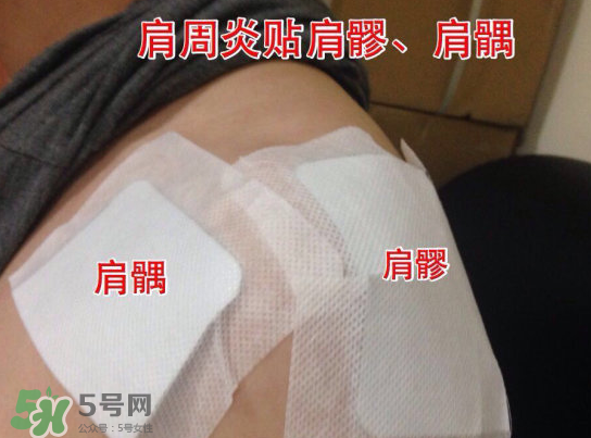 艾灸貼多少錢一盒?？艾灸貼一盒60裝多少錢？