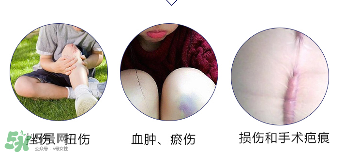 hirudoid除疤膏有效嗎？hirudoid去疤膏效果如何？