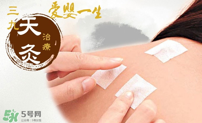 貼三伏貼可以吃魚嗎？貼三伏貼可以吃什么魚？