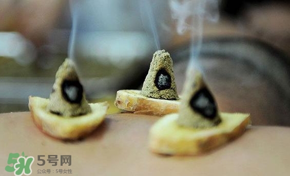 貼三伏貼可以艾灸嗎？貼三伏貼多久可以艾灸