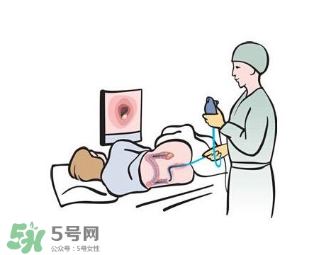 直腸癌怎么查出來的？直腸癌怎么判斷早晚期