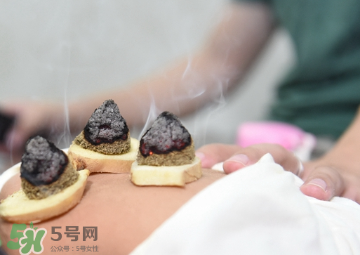 三伏灸什么人不能做？三伏灸適合哪些人？