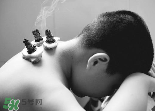 三伏灸什么人不能做？三伏灸適合哪些人？