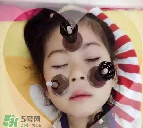 艾灸貼可以治咳嗽嗎？艾灸貼可以治退燒嗎？