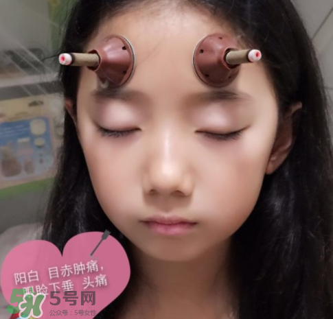 艾灸貼可以治咳嗽嗎？艾灸貼可以治退燒嗎？