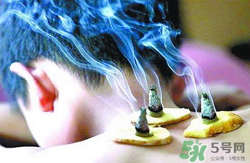 三伏灸什么時候開始灸？三伏灸怎么灸？