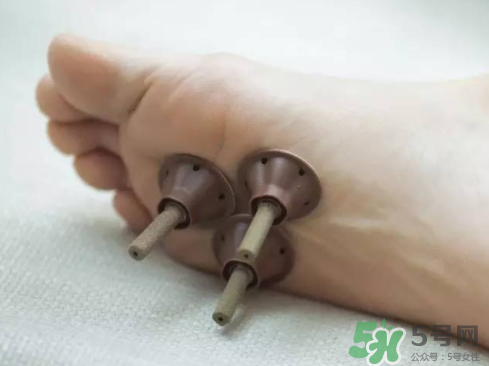 艾艾貼灸出水珠為什么？艾艾貼后有水珠要擦嗎？