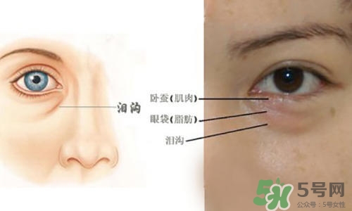 淚溝能自己恢復(fù)嗎？淚溝怎么自己恢復(fù)？