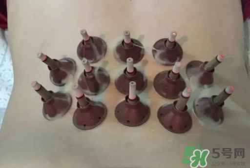 艾艾貼可以貼肚臍眼嗎？艾艾貼貼肚臍有什么作用？