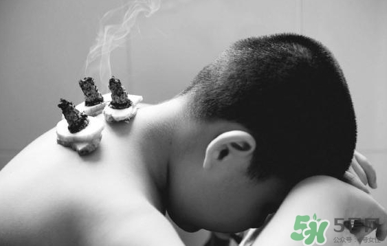 三伏灸要灸幾次？三伏灸要灸多久？