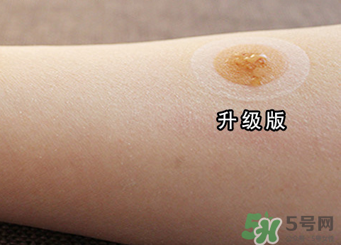 艾灸貼后有水泡怎么辦？貼艾灸貼應注意些什么？