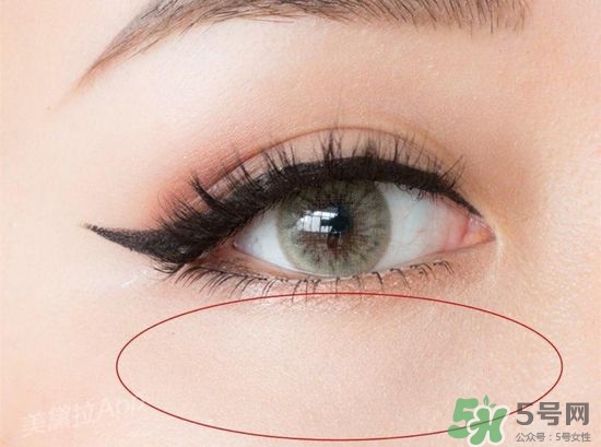玻尿酸填充淚溝多久恢復(fù)自然？玻尿酸填充淚溝的危害