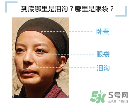 玻尿酸填充淚溝多久恢復(fù)自然？玻尿酸填充淚溝的危害