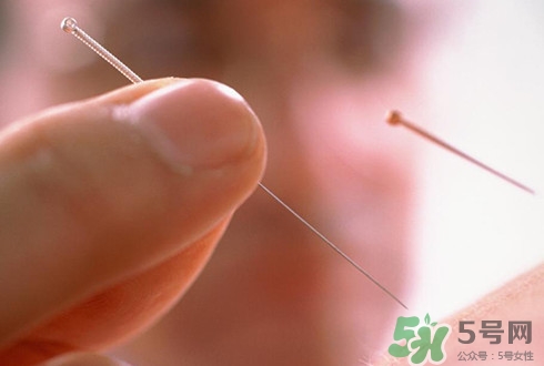 針灸可以治療失眠嗎？失眠時(shí)針灸哪些穴位有效
