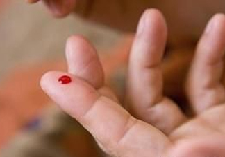 放血療法能治濕氣重嗎？放血療法治病的原理是什么