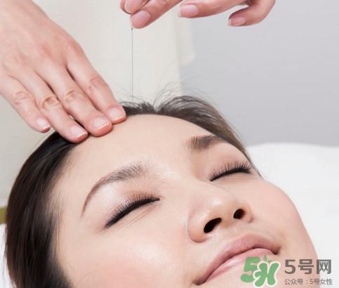 針灸到底疼不疼??？針灸最適合哪些病