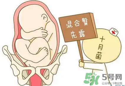 胎位不正能順產(chǎn)嗎？胎位不正怎么辦？