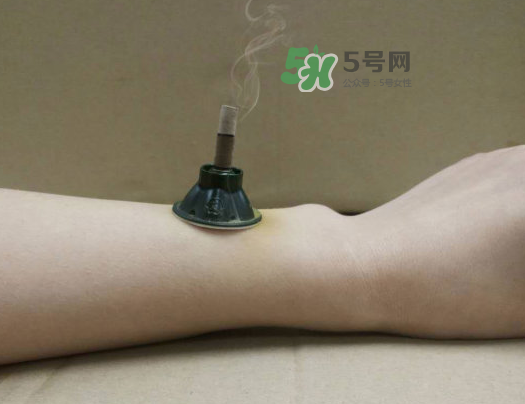 三伏天下雨可以艾灸嗎？三伏天下雨艾灸好嗎？