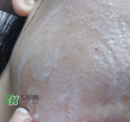 貝蜜清凈痘控油潔面啫喱怎么樣？貝蜜清祛痘控油潔面啫喱好用嗎？