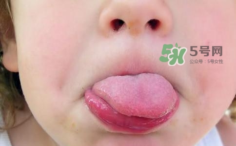 三伏天為什么濕氣重？三伏天為什么要注意祛濕？