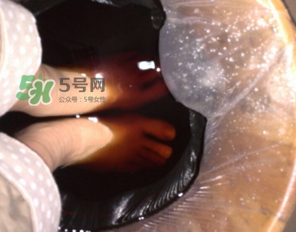 醋泡腳用白醋還是陳醋？泡腳用什么醋最好？