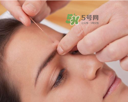 三伏天針灸有什么好處？三伏天針灸注意什么？