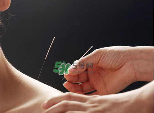 三伏天針灸有什么好處？三伏天針灸注意什么？