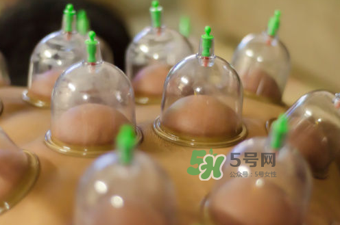 拔火罐是夏天好還是冬天好？什么時(shí)候拔火罐最合適？