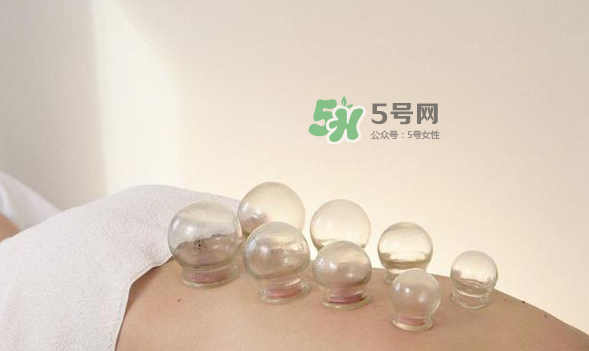 拔火罐是夏天好還是冬天好？什么時(shí)候拔火罐最合適？